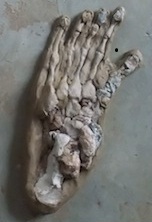 Laura's Little Foot